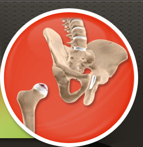 Anterior Hip Replacement Dallas