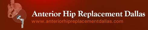 Anterior Hip Replacement Dallas